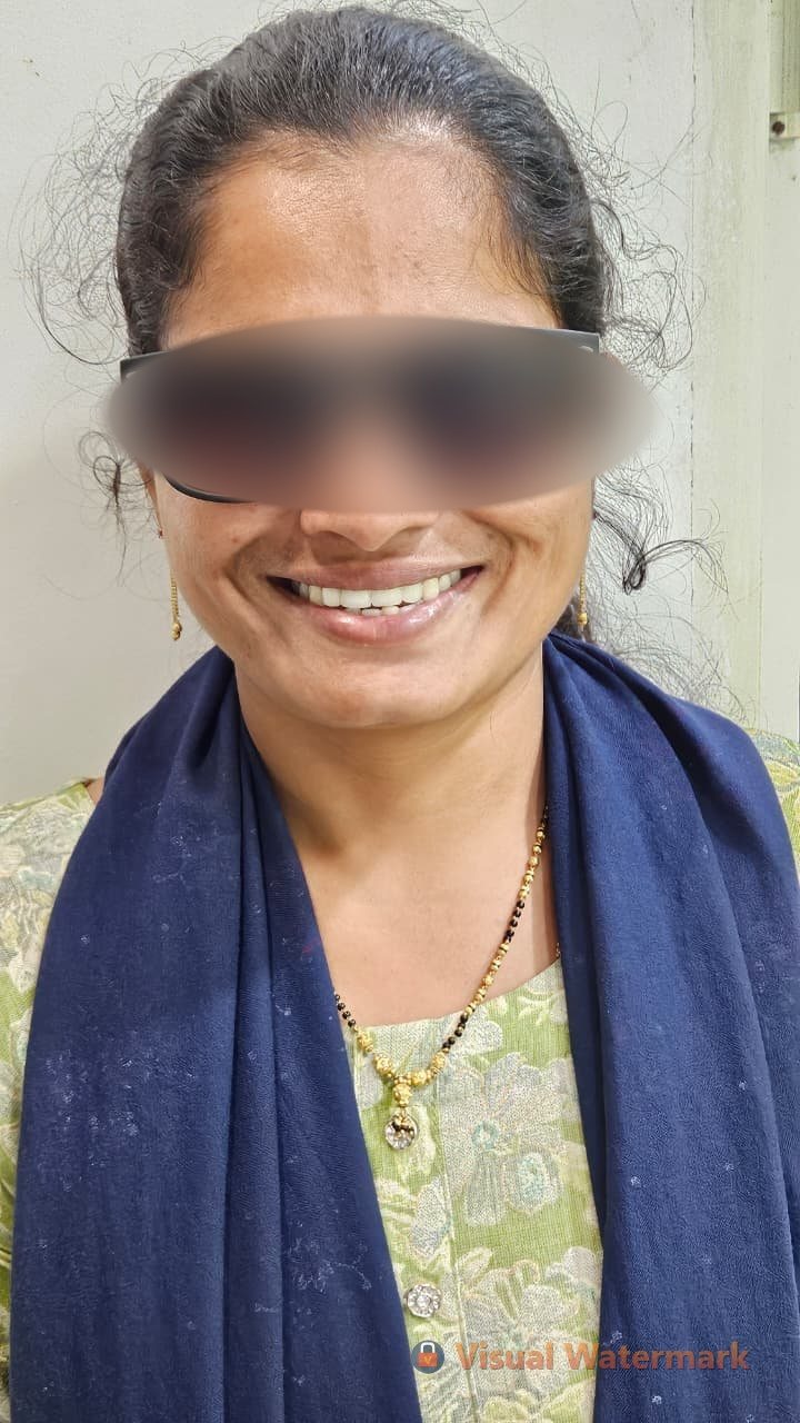 Dental treatment after — patient 6 smile transformation at Durge Dental Mancherial
