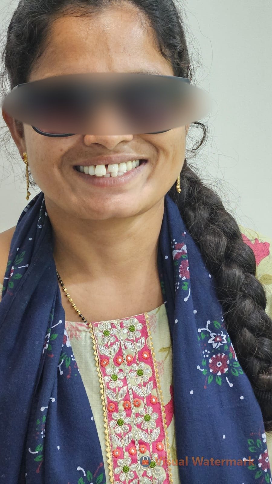 Dental treatment before — patient 6 at Durge Dental Clinic Mancherial