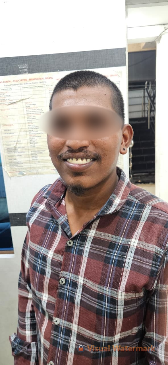 Dental treatment after — patient 1 smile transformation at Durge Dental Mancherial