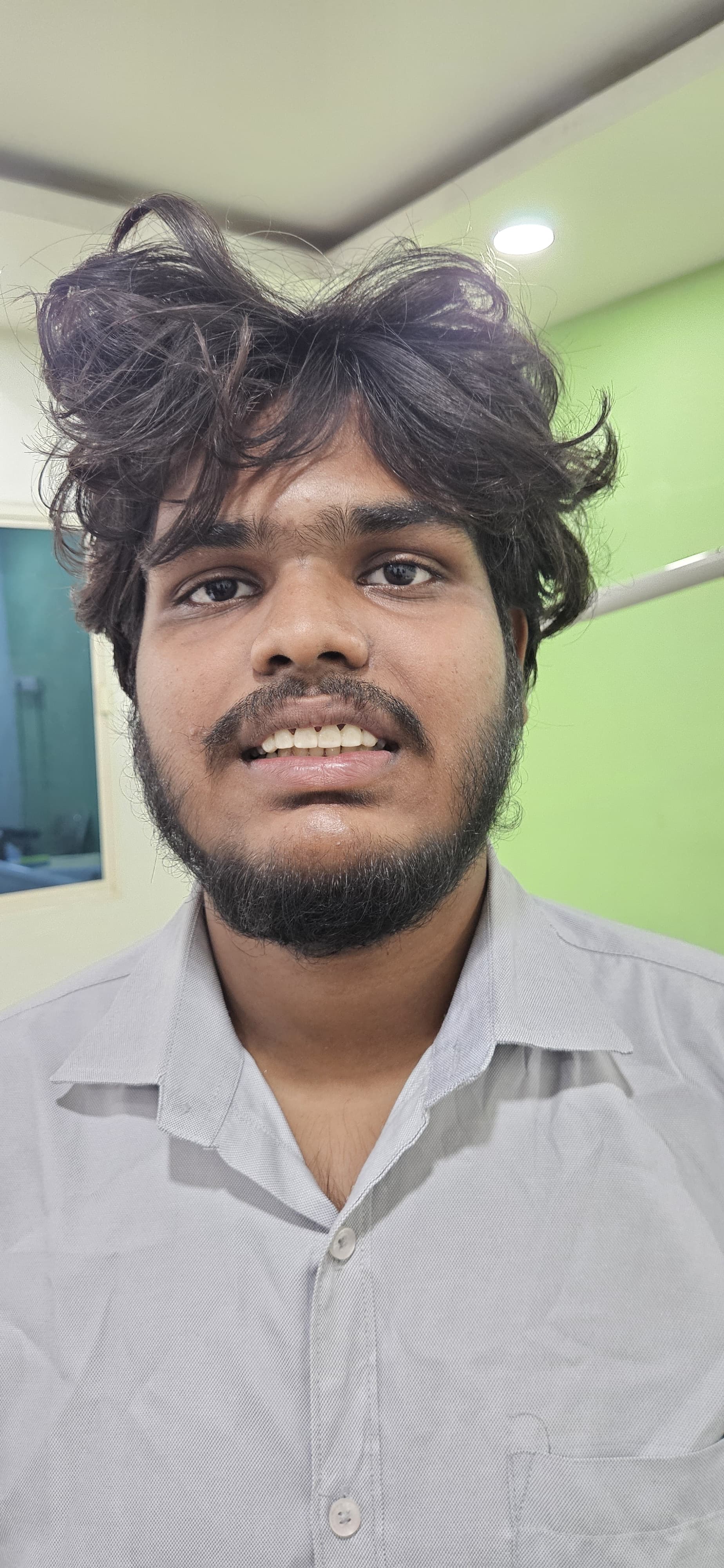 Dental treatment after — patient 6 smile transformation at Durge Dental Mancherial