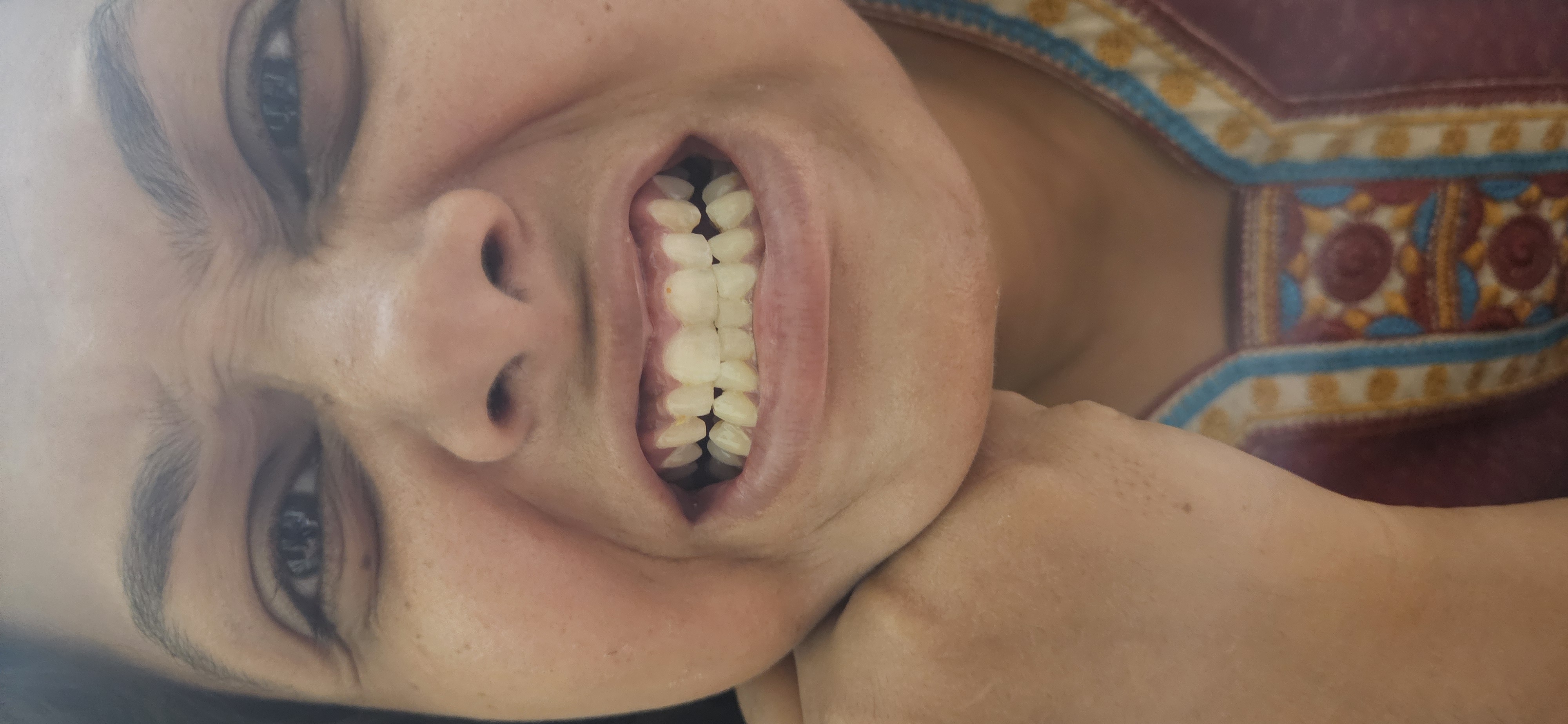 Dental treatment before — patient 2 at Durge Dental Clinic Mancherial