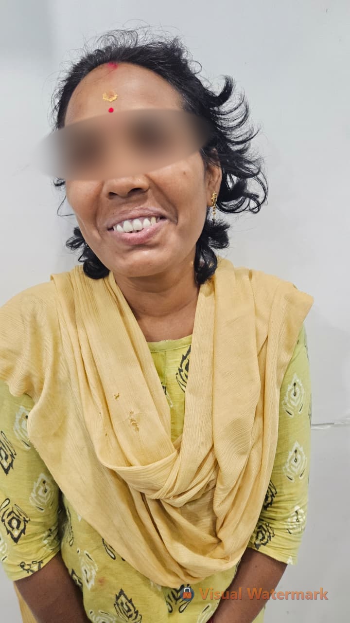 Dental treatment before — patient 3 at Durge Dental Clinic Mancherial